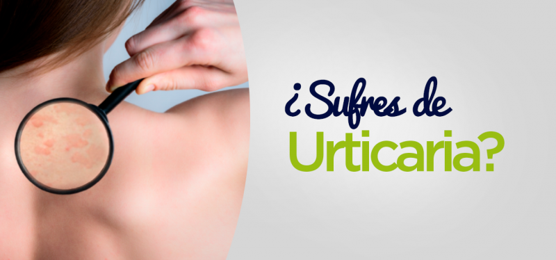 Urticaria